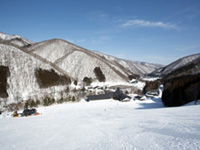 会津高原高畑スキー場（北日光・高畑スキー場）の写真